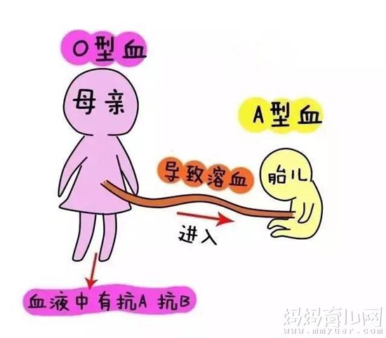 abo溶血癥的孩子能要嗎,關(guān)于abo溶血癥的孩子能否要以及穩(wěn)定計(jì)劃評(píng)估的思考,數(shù)據(jù)支持方案設(shè)計(jì)_Windows63.25.66