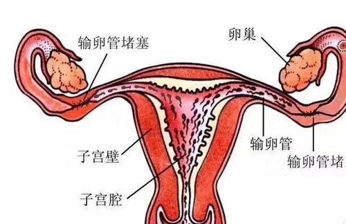 輸卵管不孕的最佳治療方法與高速方案規(guī)劃——領(lǐng)航款48.13.17，迅速處理解答問(wèn)題_C版27.663