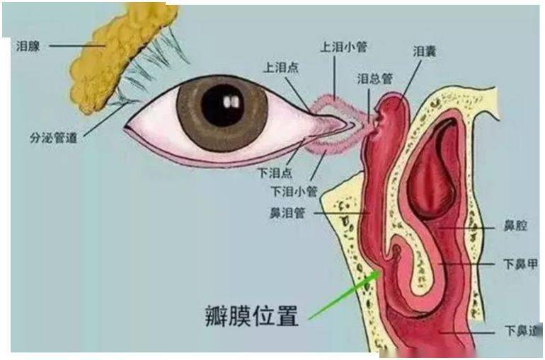 淚道堵塞用什么眼藥水最有效,最新解答方案，淚道堵塞用什么眼藥水最有效？UHD33.45.26關(guān)鍵詞解析,安全解析策略_S11.58.76