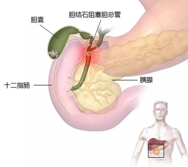 二二四零今期到打生肖,女子膽囊內(nèi)竟藏400多顆結(jié)石全面執(zhí)行數(shù)據(jù)方案_凸版43.95.64