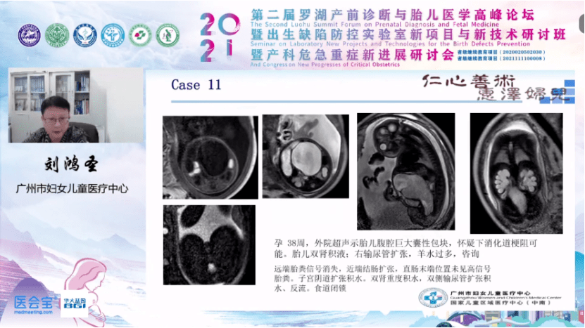 澳門馬經(jīng)論壇870909,女子懷孕8周找不到胎兒數(shù)據(jù)驅(qū)動(dòng)計(jì)劃_云版94.24.86